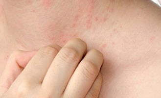 %e0%b8%9c%e0%b8%b7%e0%b9%88%e0%b8%99%e0%b8%84%e0%b8%b1%e0%b8%99-%e0%b8%ad%e0%b8%a2%e0%b9%88%e0%b8%b2%e0%b9%80%e0%b8%81%e0%b8%b2-scratch