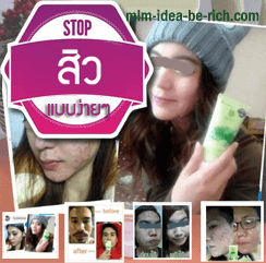%e0%b8%a7%e0%b8%b4%e0%b8%98%e0%b8%b5%e0%b8%a3%e0%b8%b1%e0%b8%81%e0%b8%a9%e0%b8%b2%e0%b8%aa%e0%b8%b4%e0%b8%a7-aloe-vera