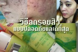 %e0%b8%a7%e0%b8%b4%e0%b8%98%e0%b8%b5%e0%b8%a5%e0%b8%94%e0%b8%a3%e0%b8%ad%e0%b8%a2%e0%b8%aa%e0%b8%b4%e0%b8%a7-acne-aloe-vera