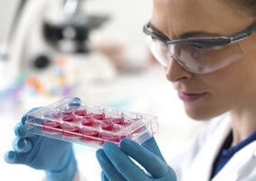 %e0%b9%84%e0%b8%82%e0%b8%81%e0%b8%a3%e0%b8%b0%e0%b8%94%e0%b8%b9%e0%b8%81-transplantation