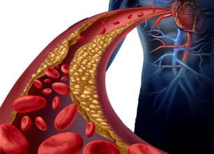 %e0%b8%84%e0%b8%ad%e0%b9%80%e0%b8%a5%e0%b8%aa%e0%b9%80%e0%b8%95%e0%b8%ad%e0%b8%a3%e0%b8%ad%e0%b8%a5-beware-cholesterol