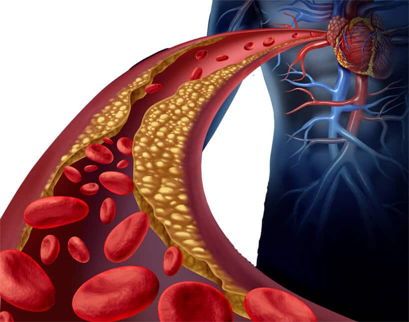 %e0%b8%84%e0%b8%ad%e0%b9%80%e0%b8%a5%e0%b8%aa%e0%b9%80%e0%b8%95%e0%b8%ad%e0%b8%a3%e0%b8%ad%e0%b8%a5-beware-cholesterol