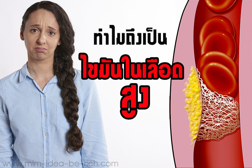 %e0%b9%84%e0%b8%82%e0%b8%a1%e0%b8%b1%e0%b8%99%e0%b9%83%e0%b8%99%e0%b9%80%e0%b8%a5%e0%b8%b7%e0%b8%ad%e0%b8%94-hyperlipidemia