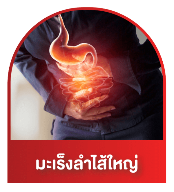 มะเร็งลำไส้ใหญ่