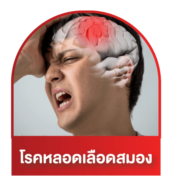 โรคหลอดเลือดสมอง